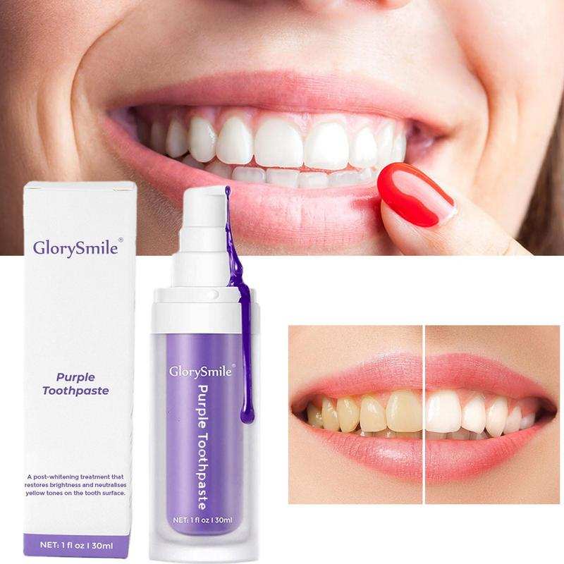 GLORY SMILE – Kit blanchiment