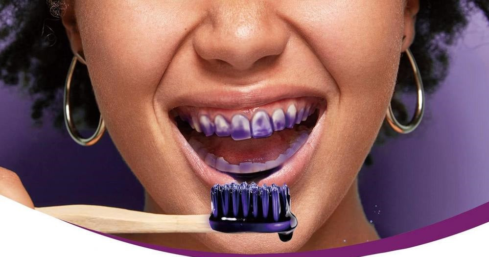 GLORY SMILE – Kit blanchiment