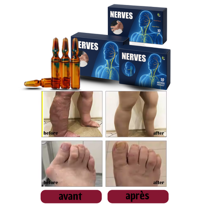 NERVES ANTI-DOULEURS